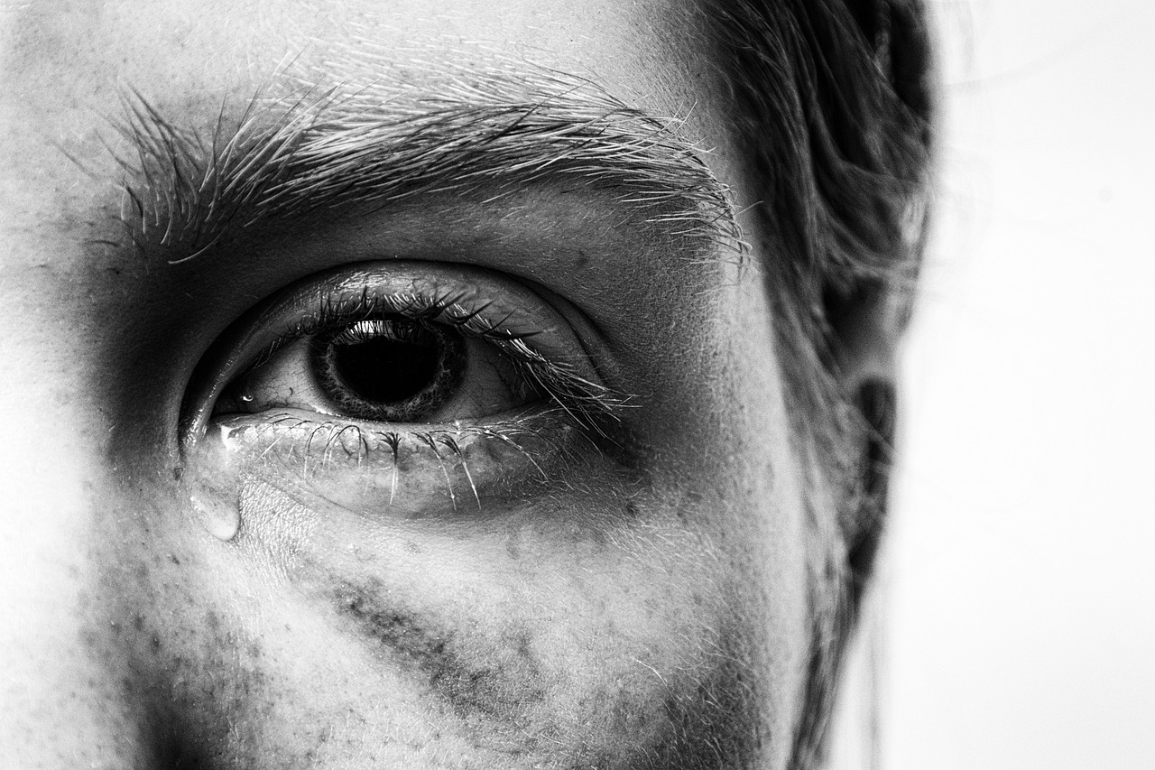 trauma, injured, tear, traumatized, pain, injury, cry, hematoma, tormented, suffering, eye, bruise, problem, tears, girl, black-and-white